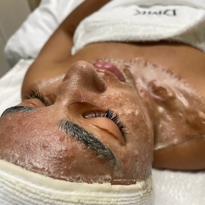 Evolution Skyn Aesthetics - Dermaplaning + Acne Expert Picture 9