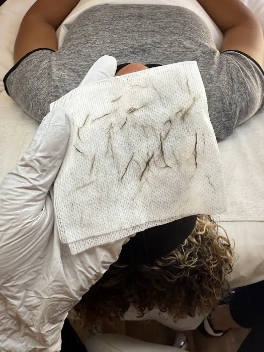 Evolution Skyn Aesthetics - Dermaplaning + Acne Expert Picture 5