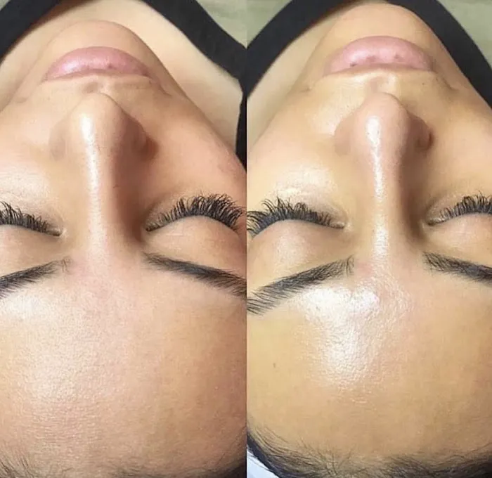 SKIN Theory Collective Picture 3