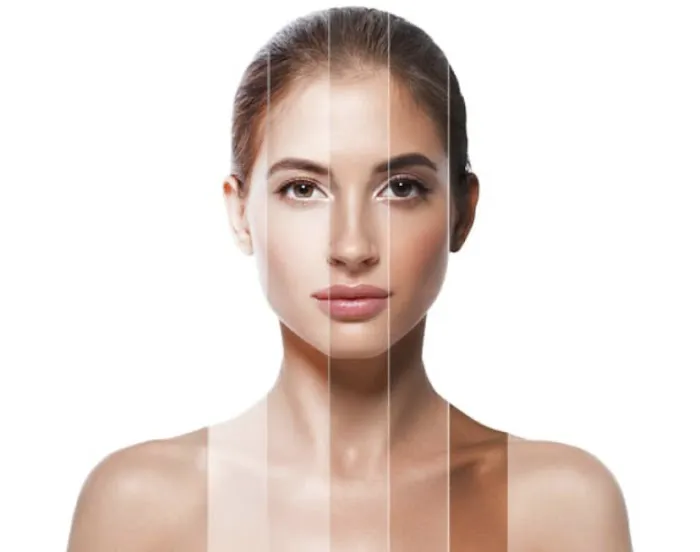 SKIN Theory Collective Picture 8