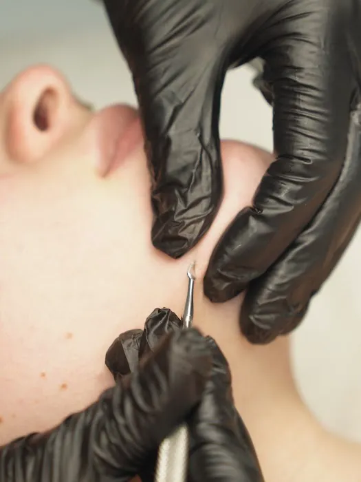 Skin Solutions LA Picture 2