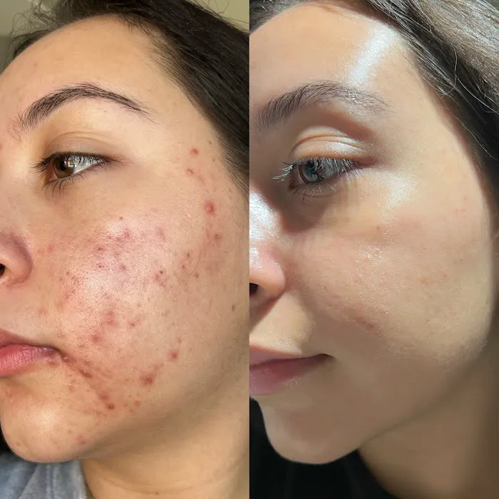 Skin Solutions LA Picture 7