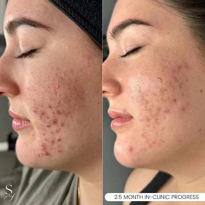 Skin Solutions LA Picture 8