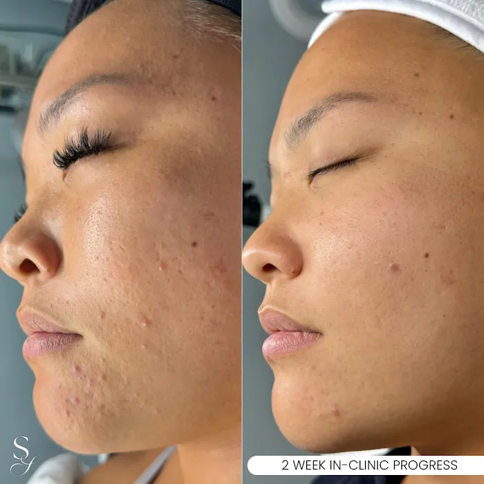 Skin Solutions LA Picture 9