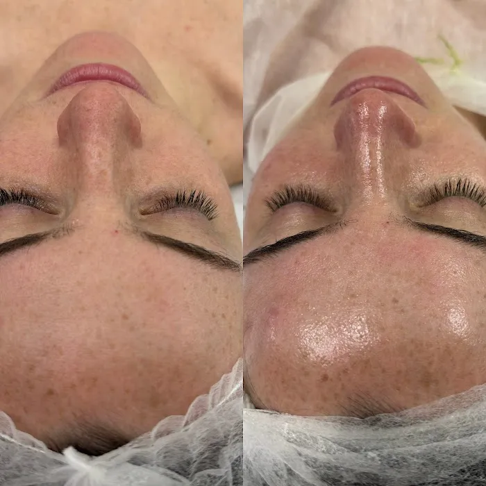 Pearl skin LA Picture 4