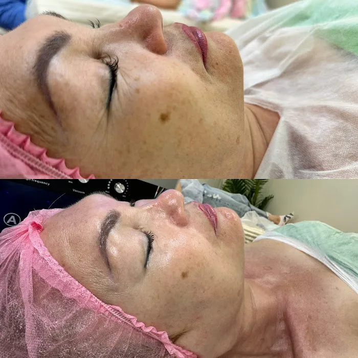 Pearl skin LA Picture 8