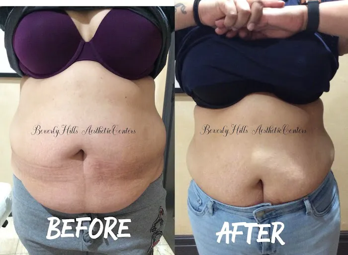 Beverly Hills Aesthetic Centers Picture 3