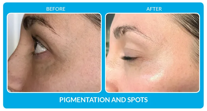 Beverly Hills Aesthetic Centers Picture 6