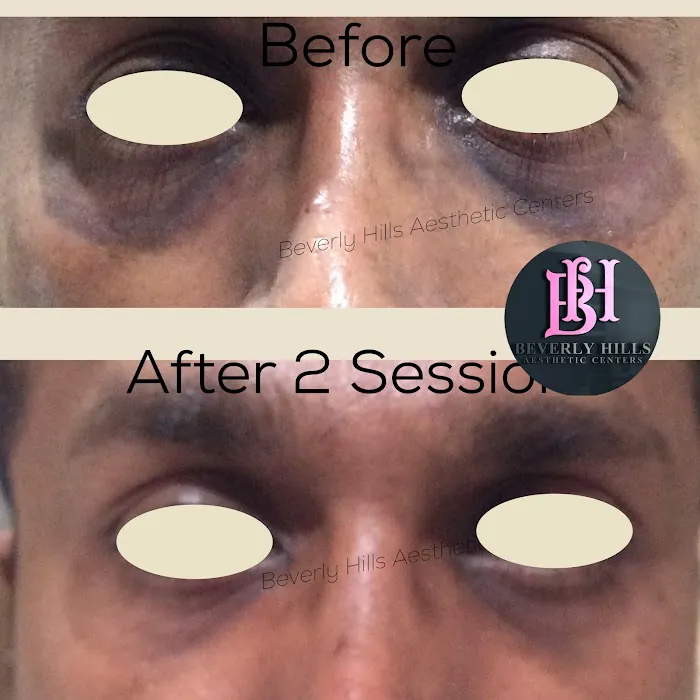 Beverly Hills Aesthetic Centers Picture 8