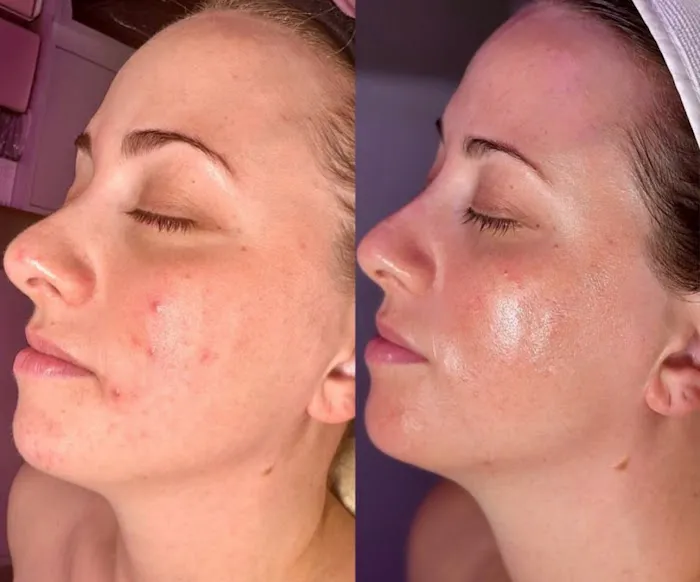 Healing Touch Beauty Spa Picture 9