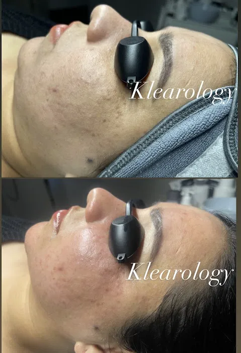 Klearology Picture 2