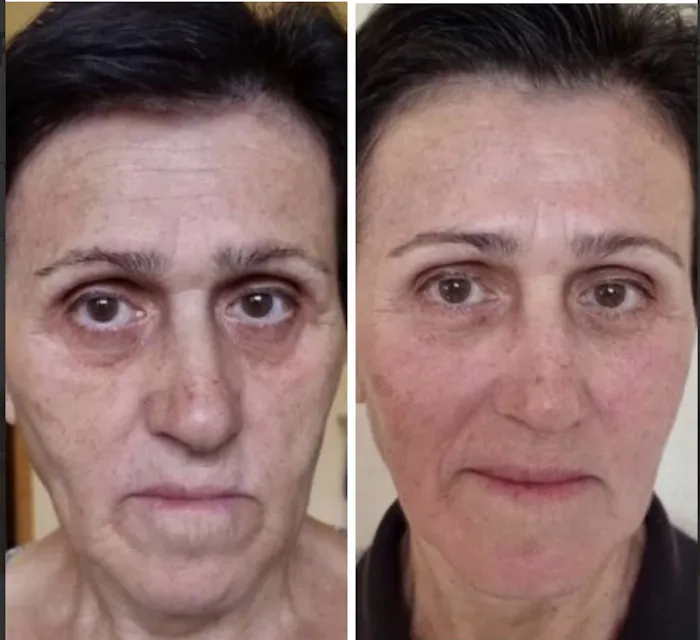 KA Esthetics Picture 2