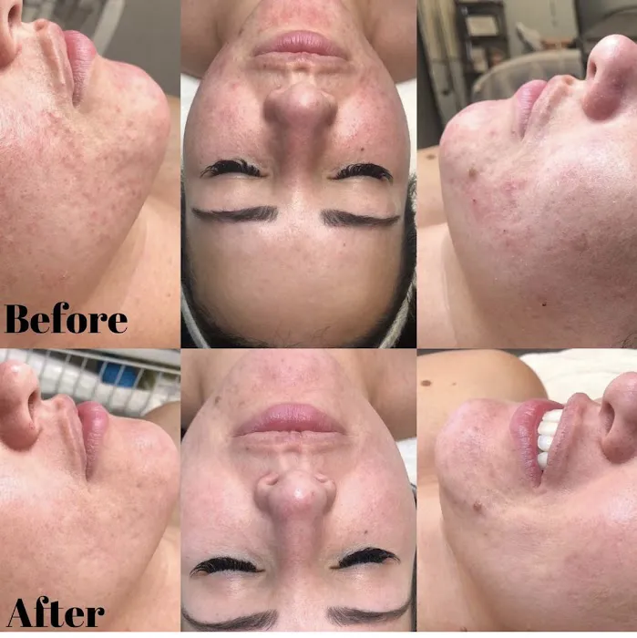 Rachel Moayer Skin Picture 2