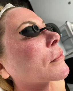 Rachel Moayer Skin Picture 5