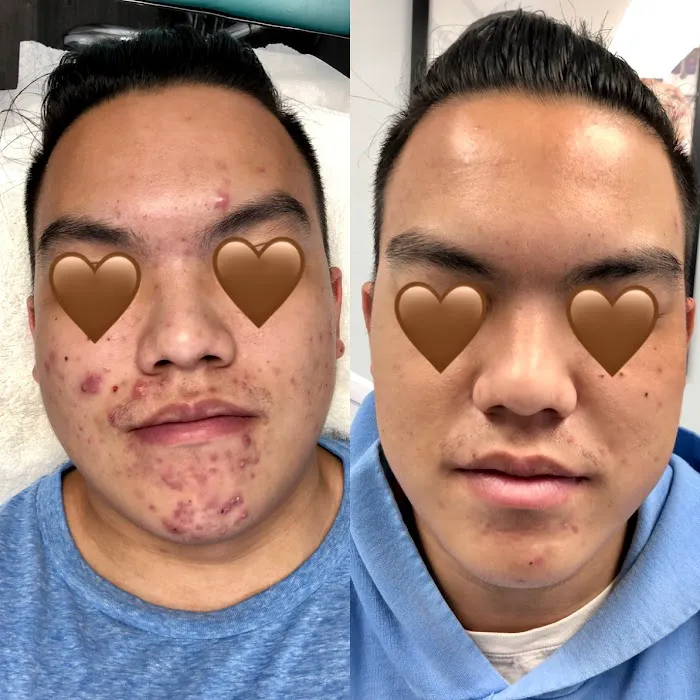 Rachel Moayer Skin Picture 7