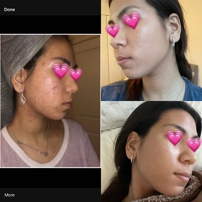 Rachel Moayer Skin Picture 6