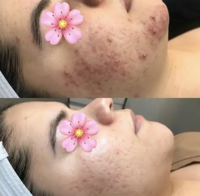 Rachel Moayer Skin Picture 8