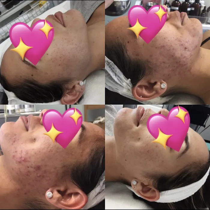 Rachel Moayer Skin Picture 4