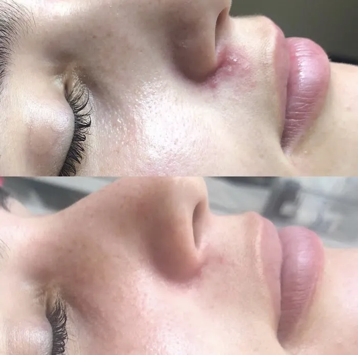 Rachel Moayer Skin Picture 10