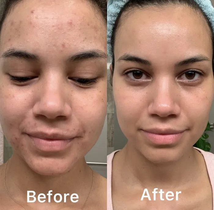 Rachel Moayer Skin Picture 9