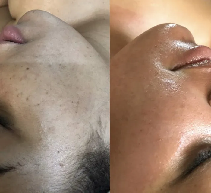 Veena Skin Care Picture 9