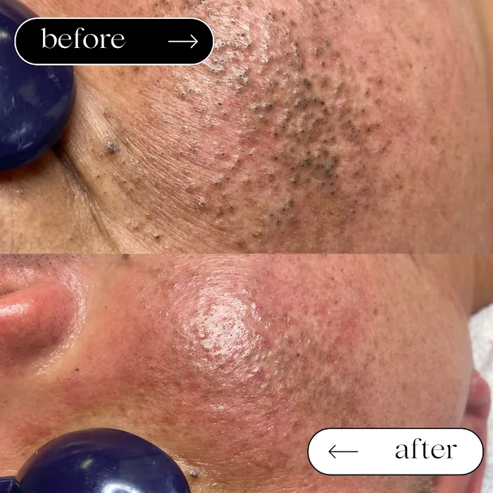 Veena Skin Care Picture 10