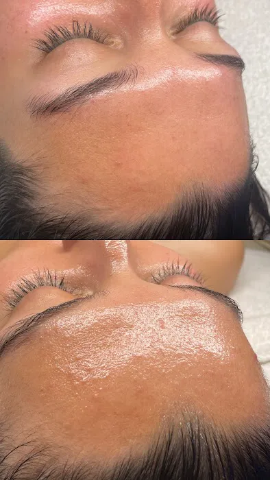 Tallie Skin Picture 4