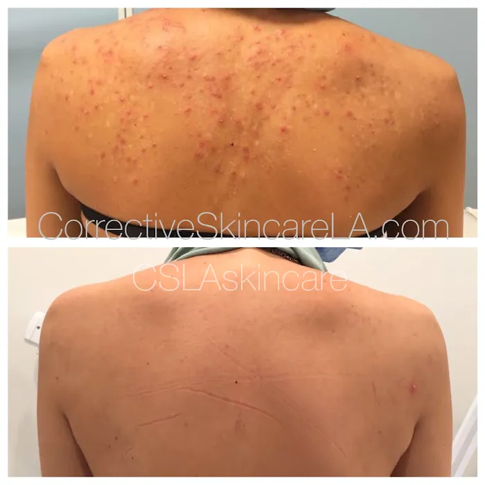 Clear Skin OC Picture 2