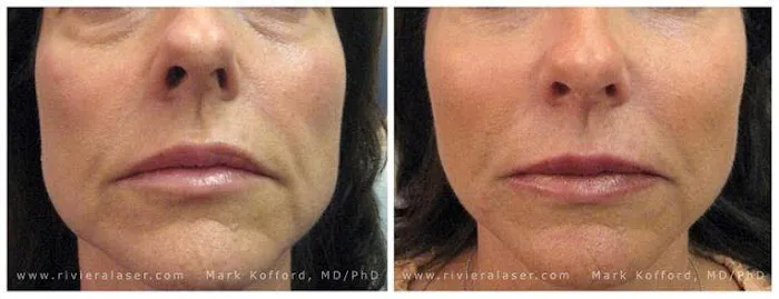 Riviera Laser Studios Picture 1