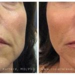 Riviera Laser Studios