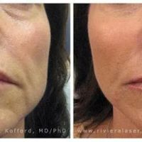 Riviera Laser Studios ico