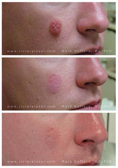 Riviera Laser Studios Picture 3