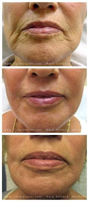 Riviera Laser Studios Picture 5