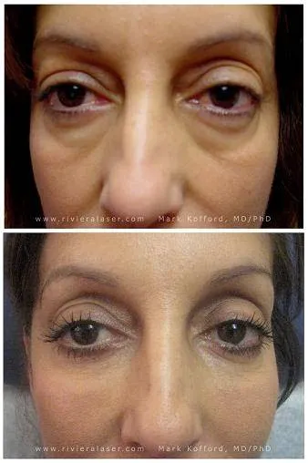 Riviera Laser Studios Picture 2