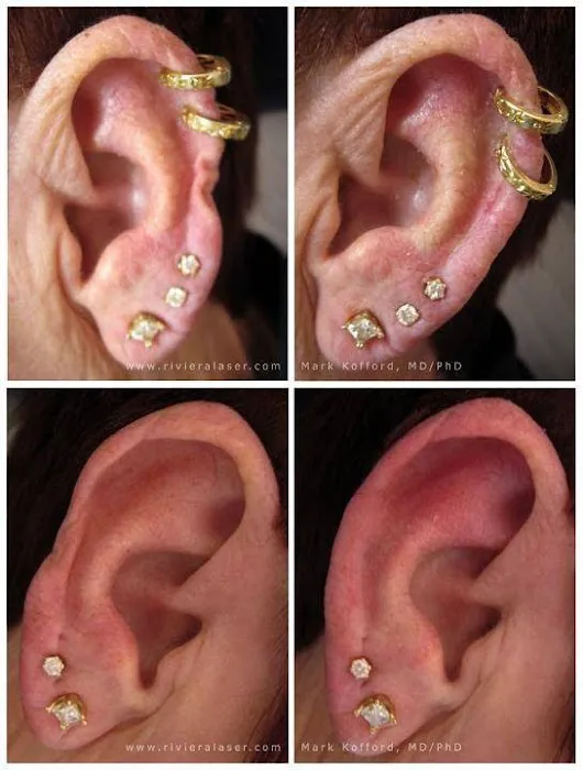 Riviera Laser Studios Picture 7