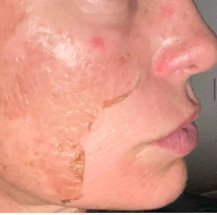 PerfectSkinOC Picture 5