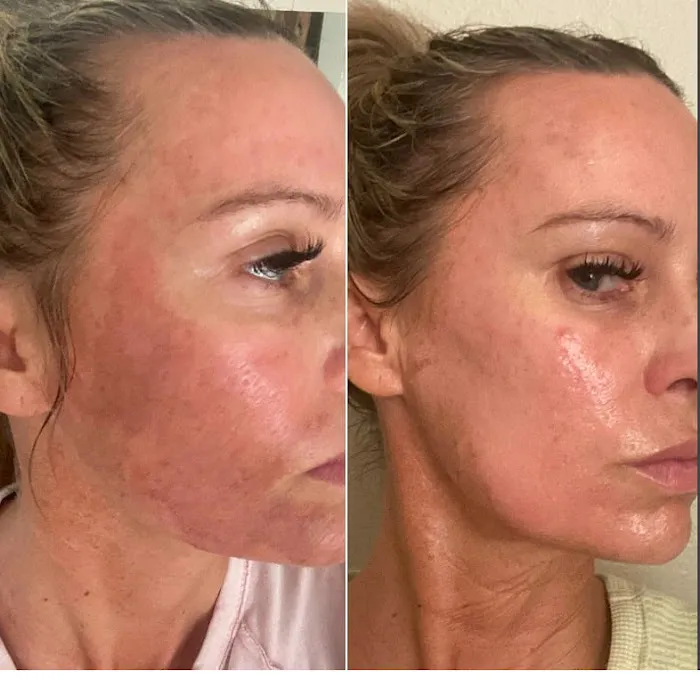 PerfectSkinOC Picture 3