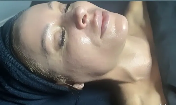 PerfectSkinOC Picture 10