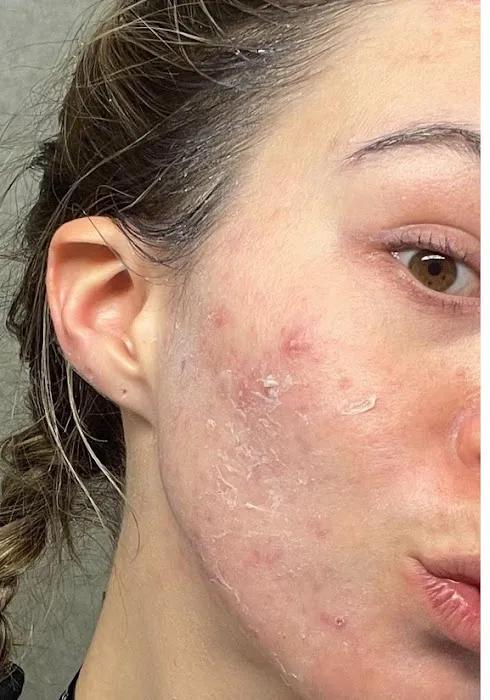 PerfectSkinOC Picture 6