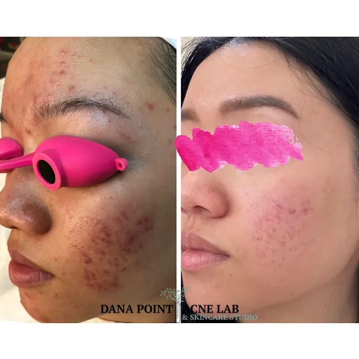 Dana Point Acne Lab & Skincare Studio Picture 10