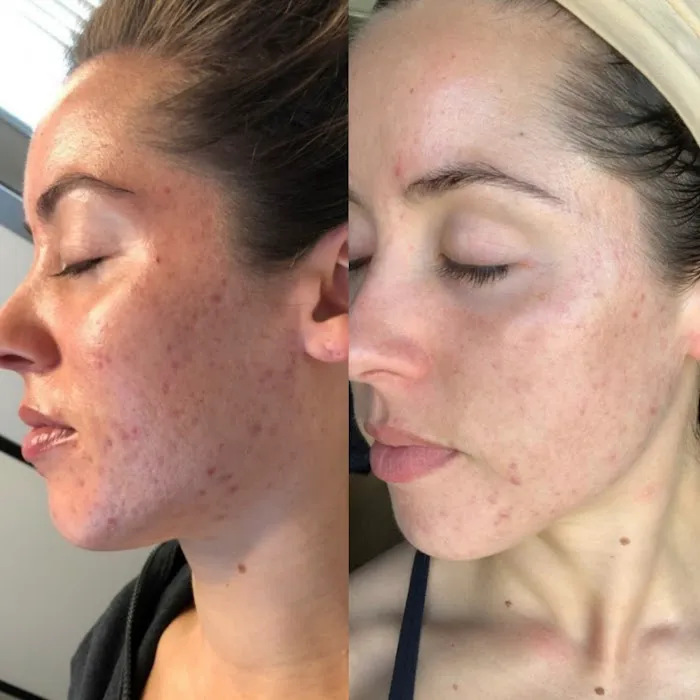 Suit Yourself Skincare Picture 7