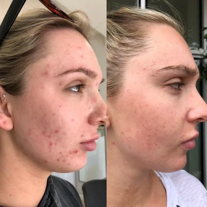 Suit Yourself Skincare Picture 10