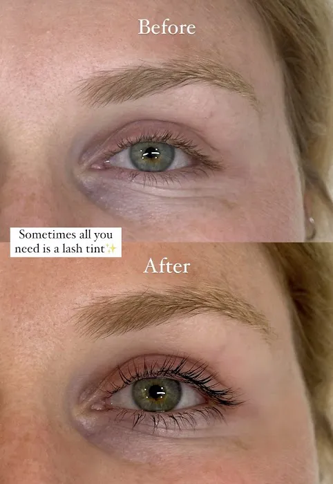 Good Skin OC Picture 9