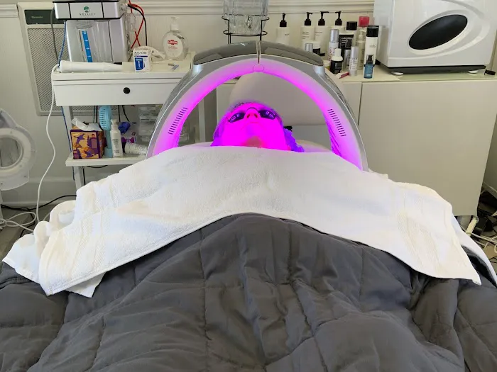 Aura Skinfit Picture 3