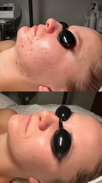 Skin Is Within Picture 8