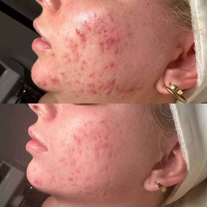 Skin Is Within Picture 7