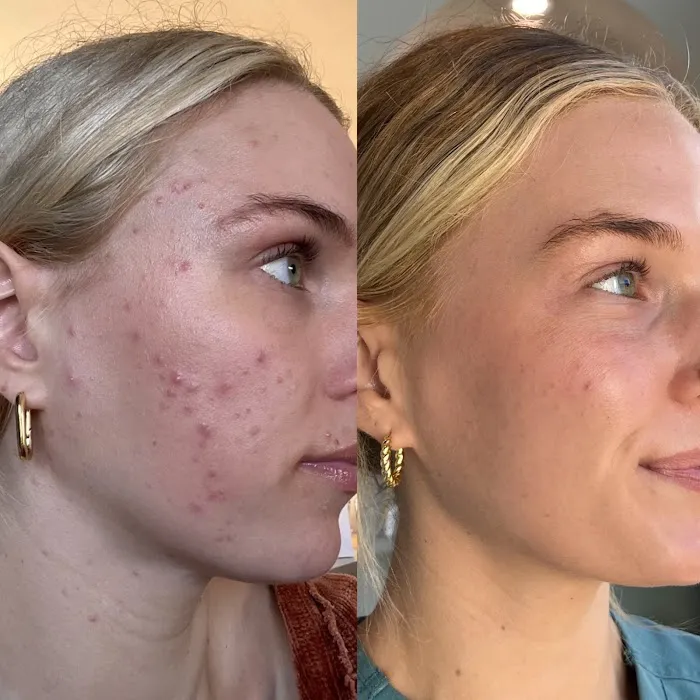 Skin Is Within Picture 5