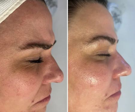 Skin Bar