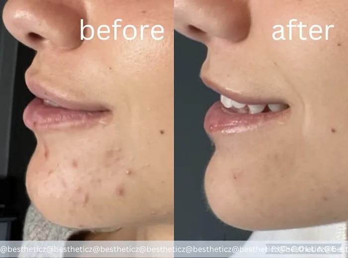 bestheticz Picture 1