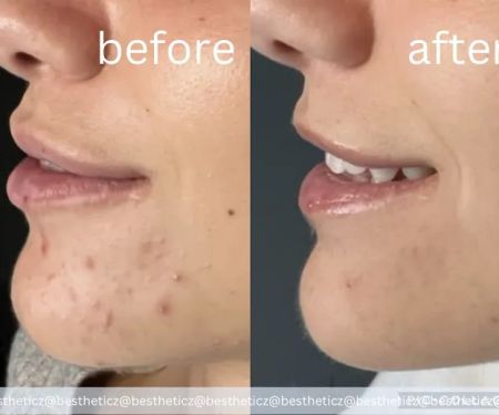 bestheticz